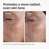 The Ordinary Glycolic Acid 7% Exfoliating Toner, Brightening and Smoothing Daily Toner for More Even-Looking Skin Tone