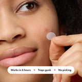 Mighty Patch™ Parche original de Hero Cosmetics – Parche hidrocoloide para acné para cubrir granos y manchas en la cara y la piel, apto para veganos y no probado en animales (36 unidades)